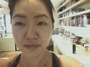 吃瓜眼睛浮肿,揭秘眼睛浮肿背后的秘密